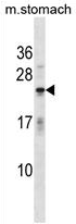 AP54323PU-N - Fast skeletal muscle Troponin I