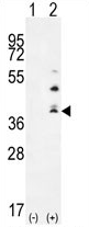 AP54314PU-N - TNFSF15