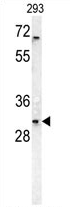 AP54313PU-N - TNFRSF6B / DCR3
