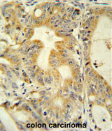 AP54313PU-N - TNFRSF6B / DCR3