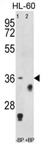 AP54309PU-N - TNFRSF14 / HVEM