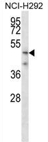 AP54301PU-N - TMPRSS5 / Spinesin