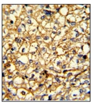 AP17872PU-N - Alpha-2B adrenergic receptor / ADRA2B