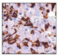 AP10282PU-N - Prolactin / PRL