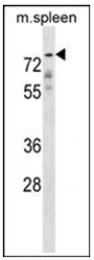 AP51901PU-N - Glypican-2