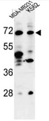 AP50586PU-N - TSPEAR / C21orf29
