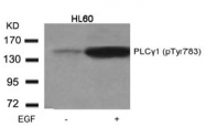 AP02395PU-S - PLCG1