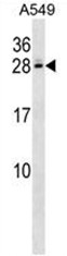 AP50624PU-N - C4b-binding protein beta