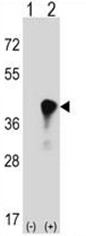 AP50624PU-N - C4b-binding protein beta