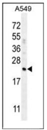 AP50877PU-N - Complement factor D