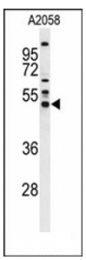 AP53855PU-N - Alpha-1-antitrypsin