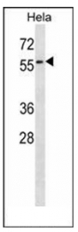 AP53849PU-N - Selenoprotein N (SEPN1)