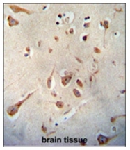 AP53865PU-N - Neuroserpin / SERPINI1