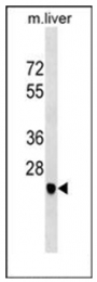 AP53887PU-N - Delta-sarcoglycan
