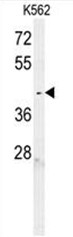AP50659PU-N - LEG1 / C6orf58
