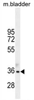 AP54235PU-N - TGIF1