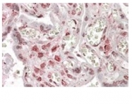 AP31860PU-N - Max-like protein X