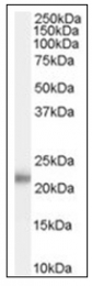 AP16632PU-N - KLK2 / Kallikrein-2
