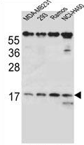 AP54207PU-N - TCRB