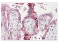AP16957PU-N - UBE2F