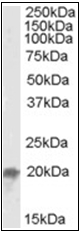 AP16957PU-N - UBE2F