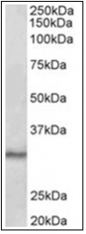 AP31837PU-N - CTDSP1