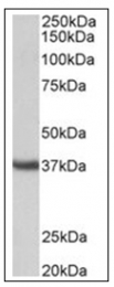 AP31850PU-N - Apolipoprotein J / Apo J