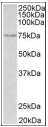 AP31853PU-N - SLC6A4 / SERT