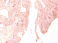 AM50102PU-S - Chromogranin A