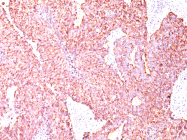 AM50103PU-S - Chromogranin A