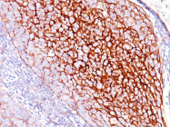 AM50104PU-N - CD35 / C3BR
