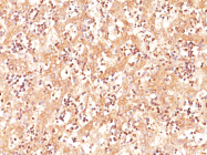 AM50105PU-S - Alpha-fetoprotein / AFP