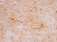 AM50113PU-N - GFAP
