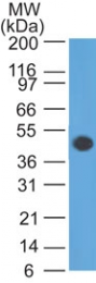 AM50113PU-N - GFAP