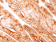 AM50127PU-S - Cytokeratin 8