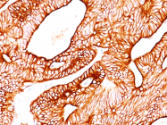 AM50128PU-S - Cytokeratin 8