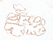 AM50130PU-S - Cytokeratin 14