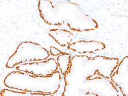 AM50130PU-S - Cytokeratin 14