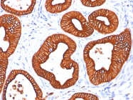 AM50132PU-S - Cytokeratin 18