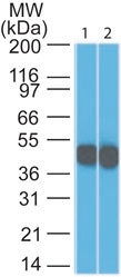 AM50132PU-S - Cytokeratin 18