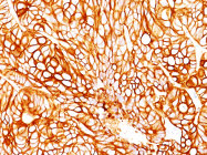 AM50133PU-S - Cytokeratin 18