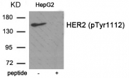 AP55859PU-S - CD340 / ERBB2 / HER2