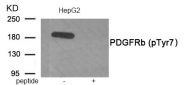 AP55863PU-N - CD140b / PDGFRB