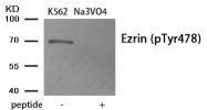AP55864PU-N - Ezrin