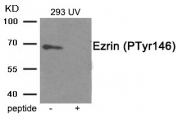 AP55865PU-N - Ezrin