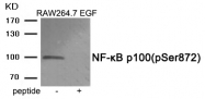 AP55875PU-S - NFKB2 / NF-kappa-B p100/p52