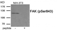 AP55876PU-S - FAK1 / PTK2