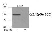 AP55879PU-S - KCNB1