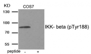 AP55884PU-S - IKBKB / IKKB