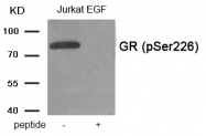 AP55889PU-S - Glucocorticoid receptor